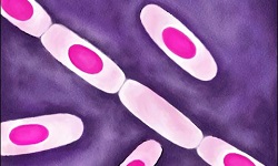 Dorner's staining